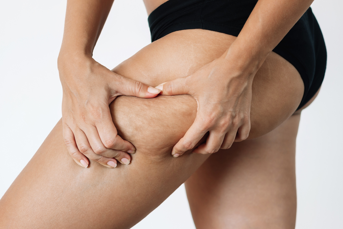 Cellulite Treatment In Thane