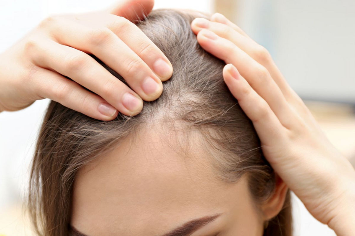 FUE Hair Transplant 