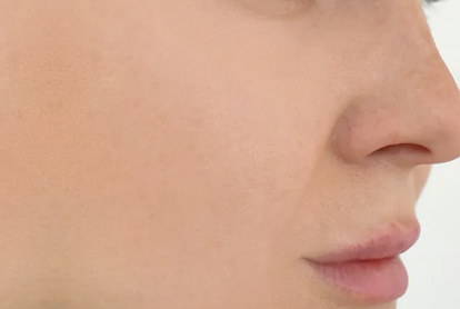 Rf Skin Tightening Facial Treatment In Thane