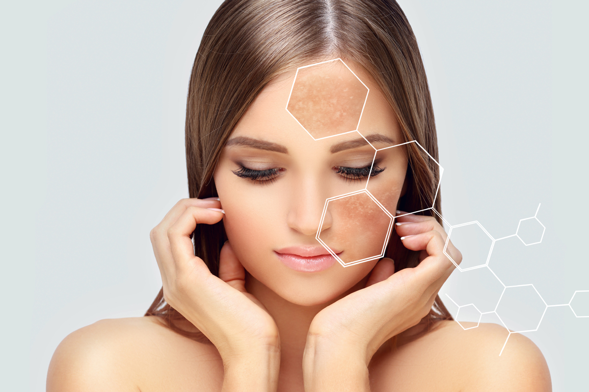 Pigmentation Treatment In Thane