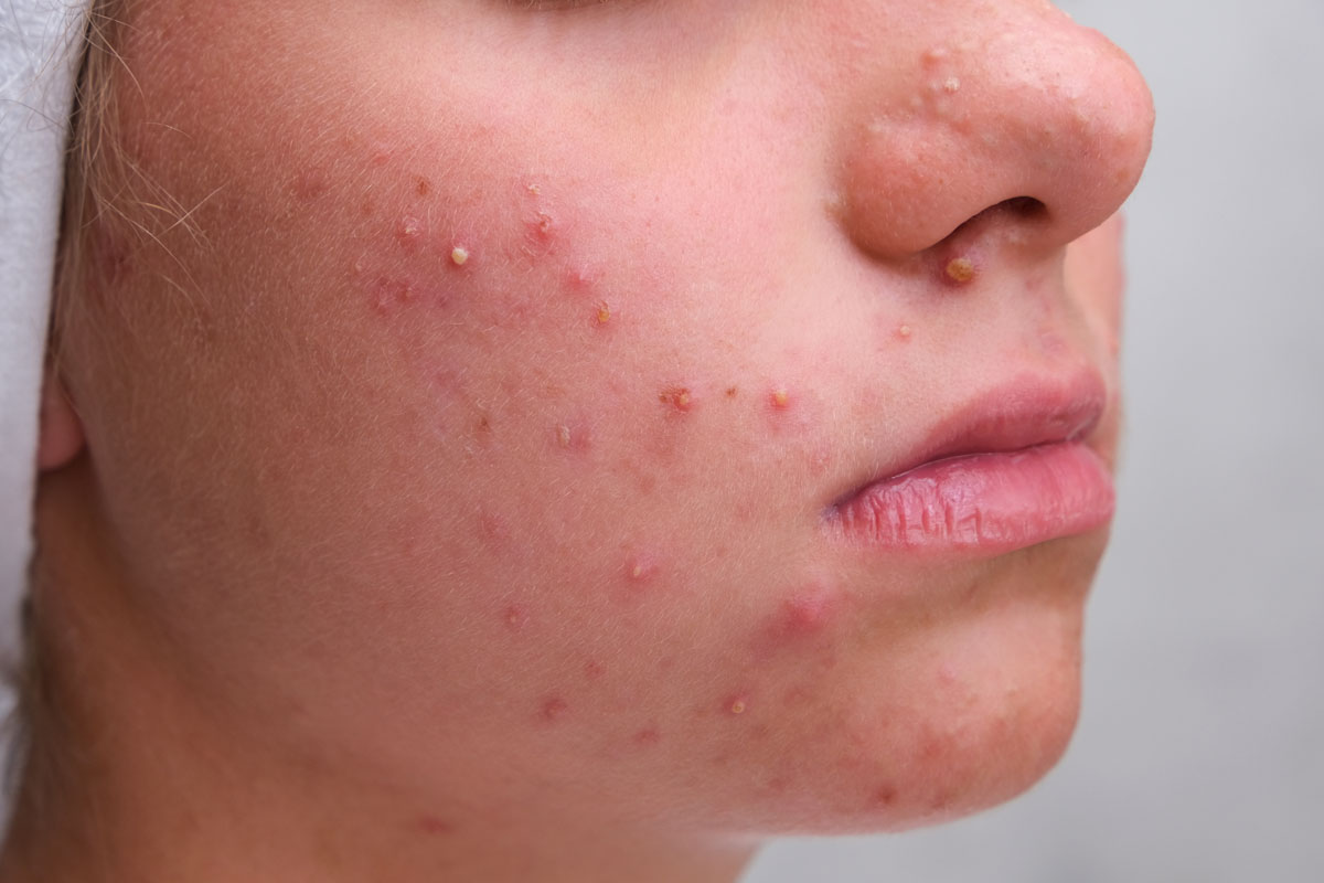 Safe, effective laser solutions for flawless skin and lasting results